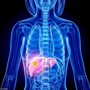 New research: The study found those who were worse off were more prone to suffering liver cancer, as well as forms of the disease affecting the larynx, penis and cervix