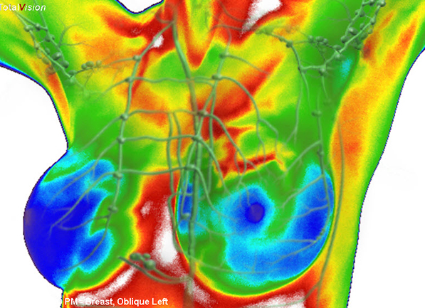 Thermography5