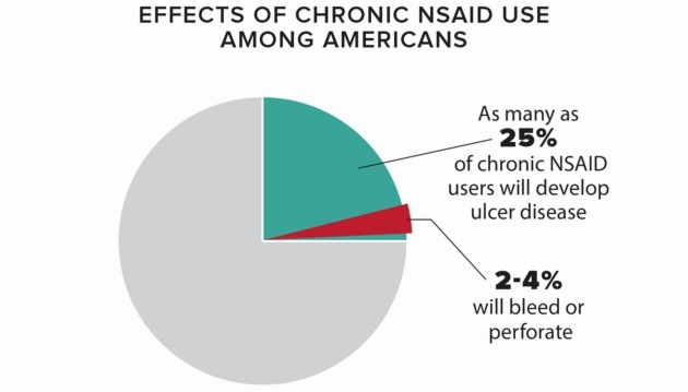 Drugs like ibuprofen and aspirin reduce pain and swelling, but they can also cause serious gastrointestinal complications over time. (Data: The American College of Gastroenterology; Chart: Lauren Giordano / The Atlantic)