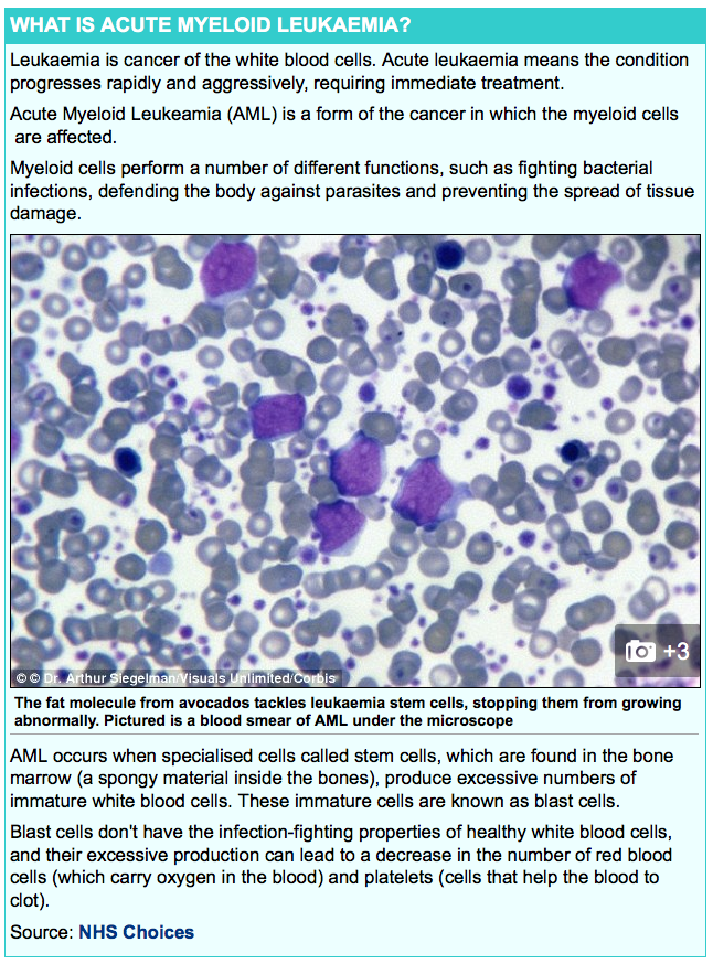 Myeloid Leukeamia