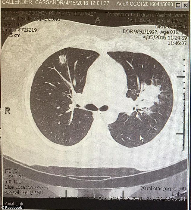 Tragic: She revealed on Facebook over the weekend that it had returned and posted a photo of the mass in her lungs (above)