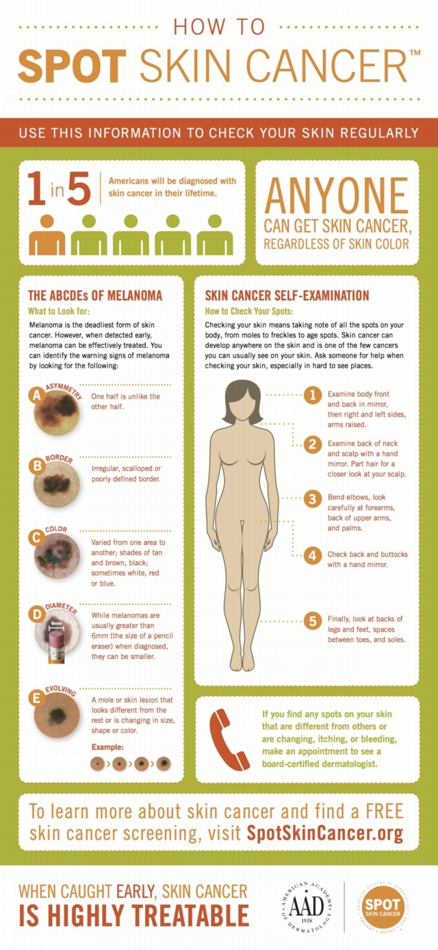 how to spot skin cancer infographic